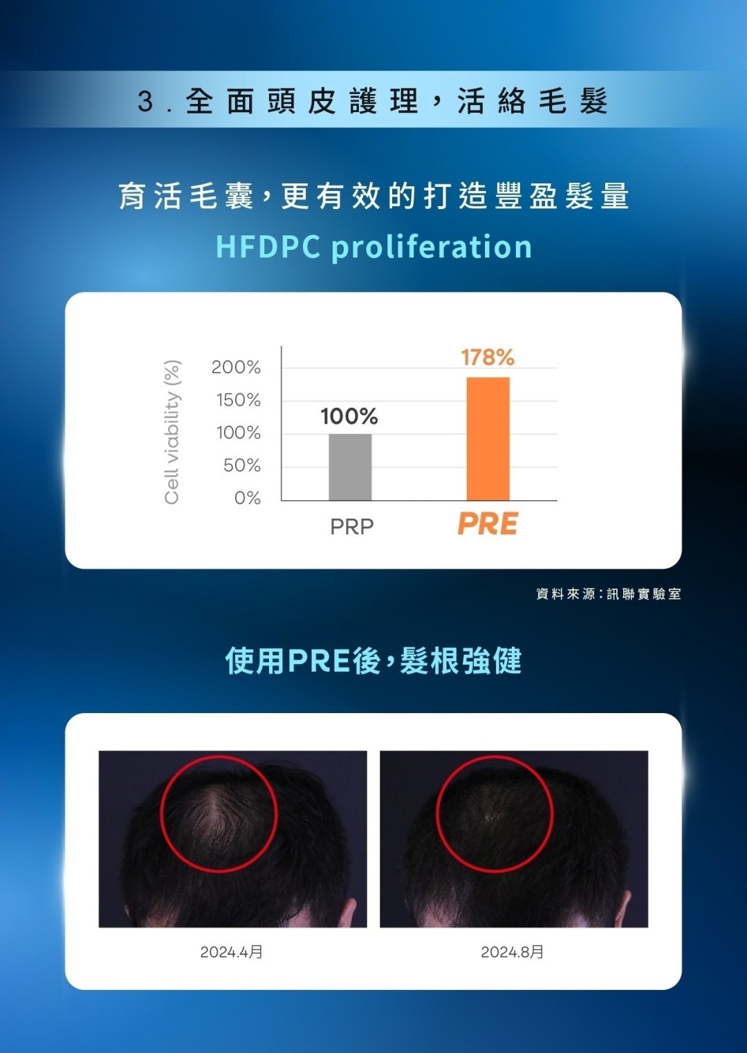 訊聯PRE全新升級