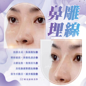 鼻雕埋線微創整鼻 - 打造完美鼻型的輕奢選擇