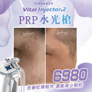 突破性護膚體驗：PRP水光槍療程