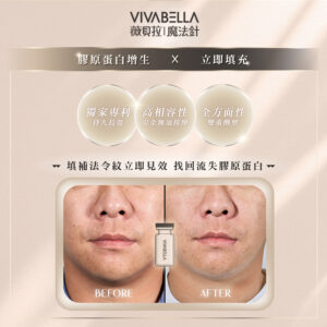 薇貝拉VIVABELLA