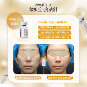 什麼是VIVABELLA 薇貝拉?