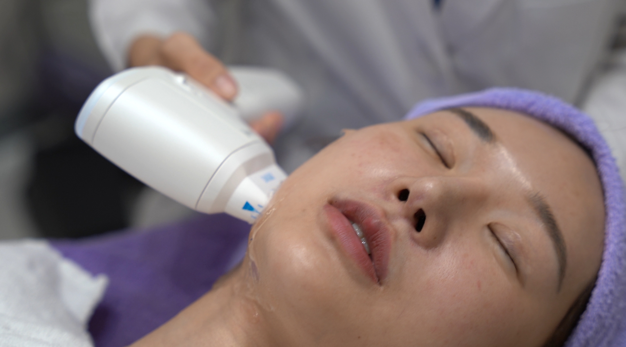 Z音波 SMAS筋膜層 → 拉提效果再進化